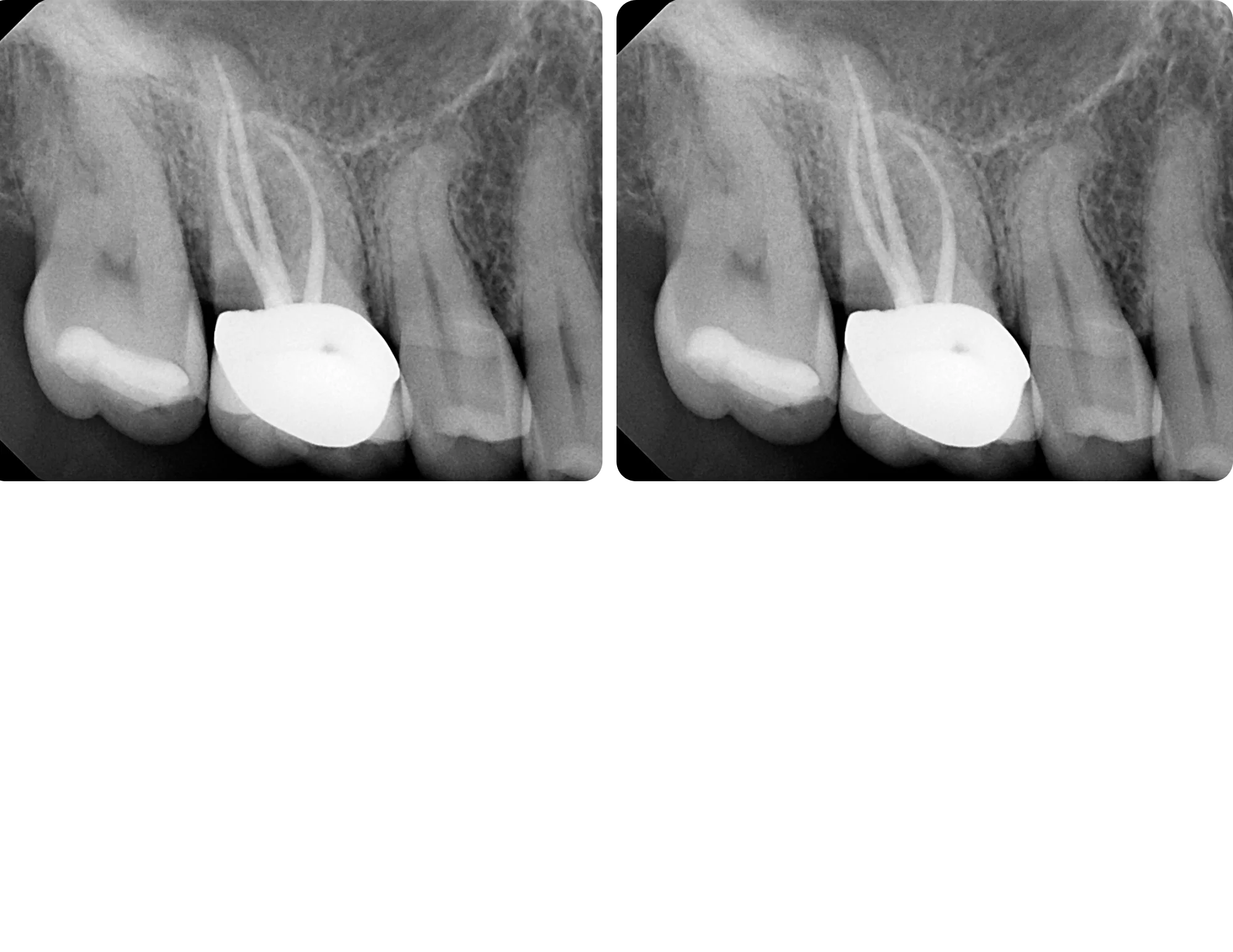 After image