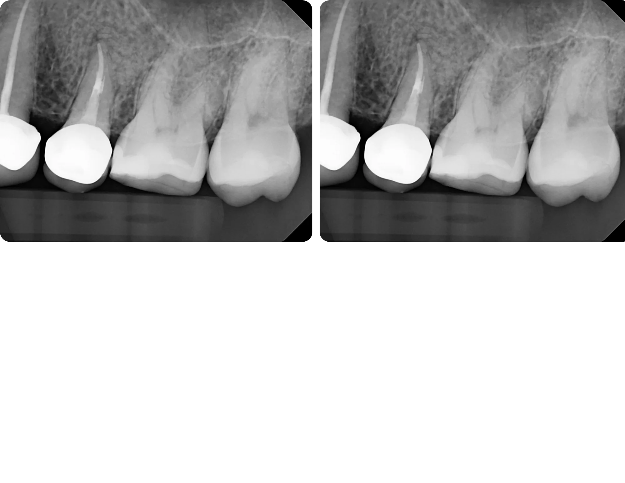 After image