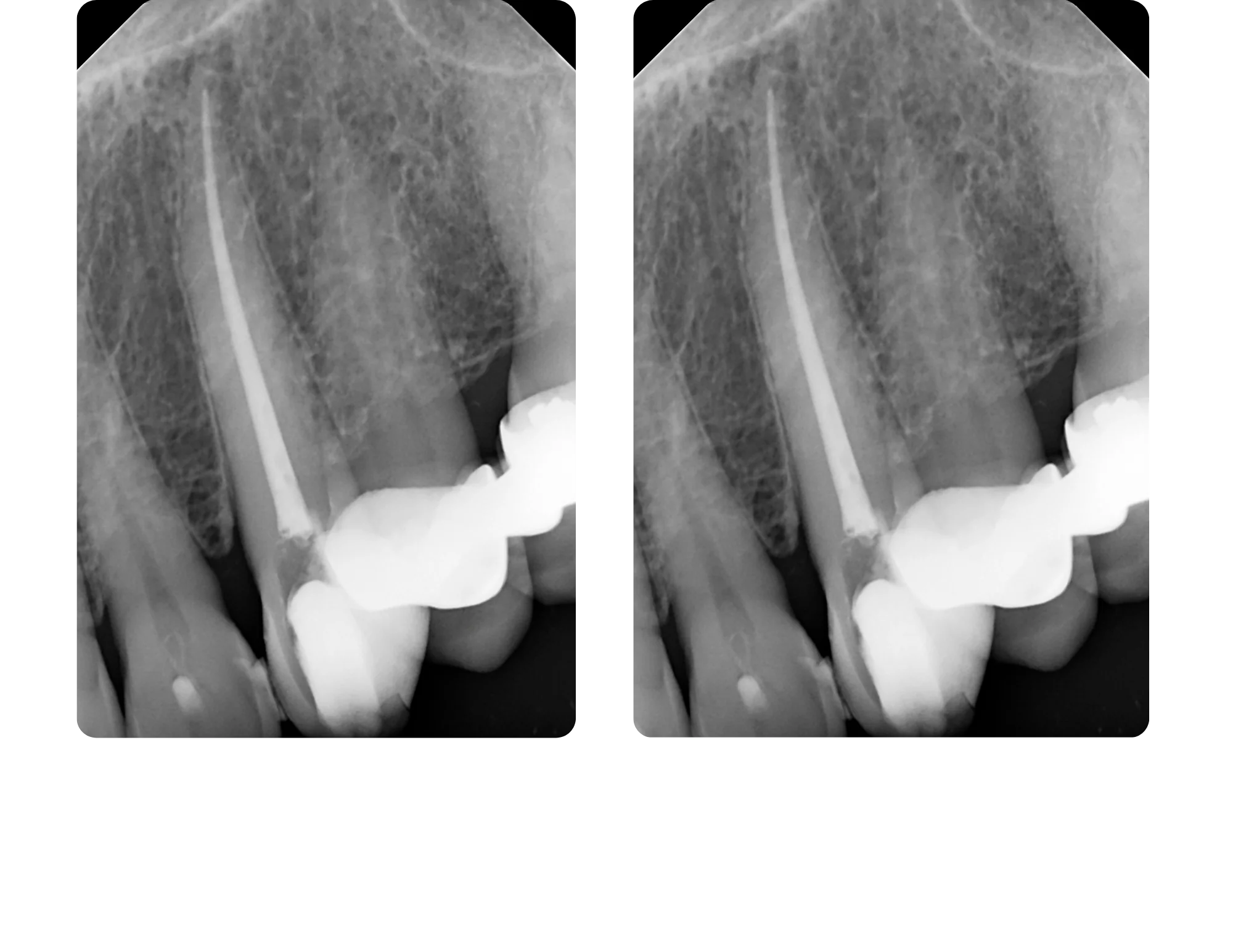 After image