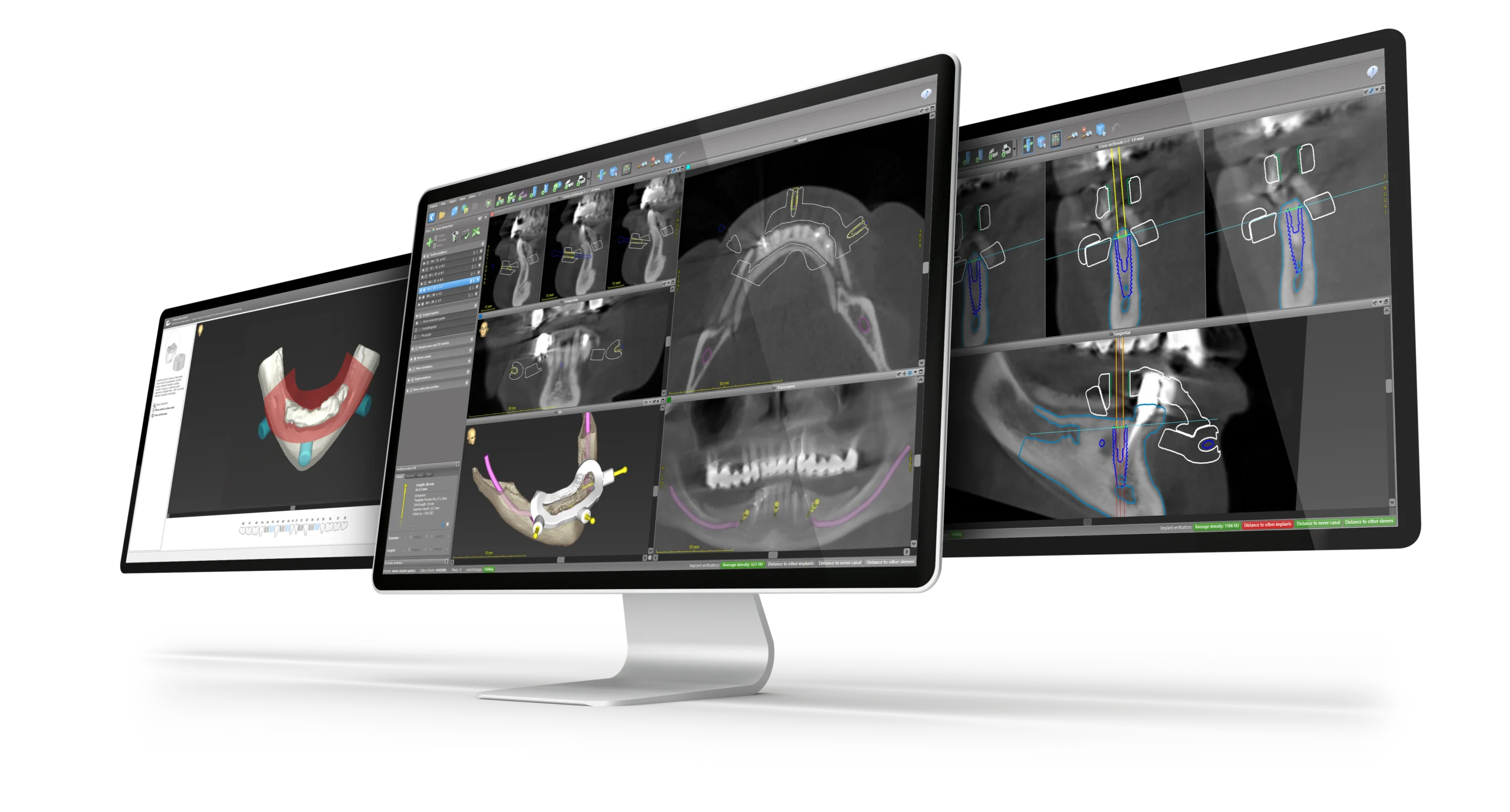Horizon Implants Thousand Oaks CA (1)