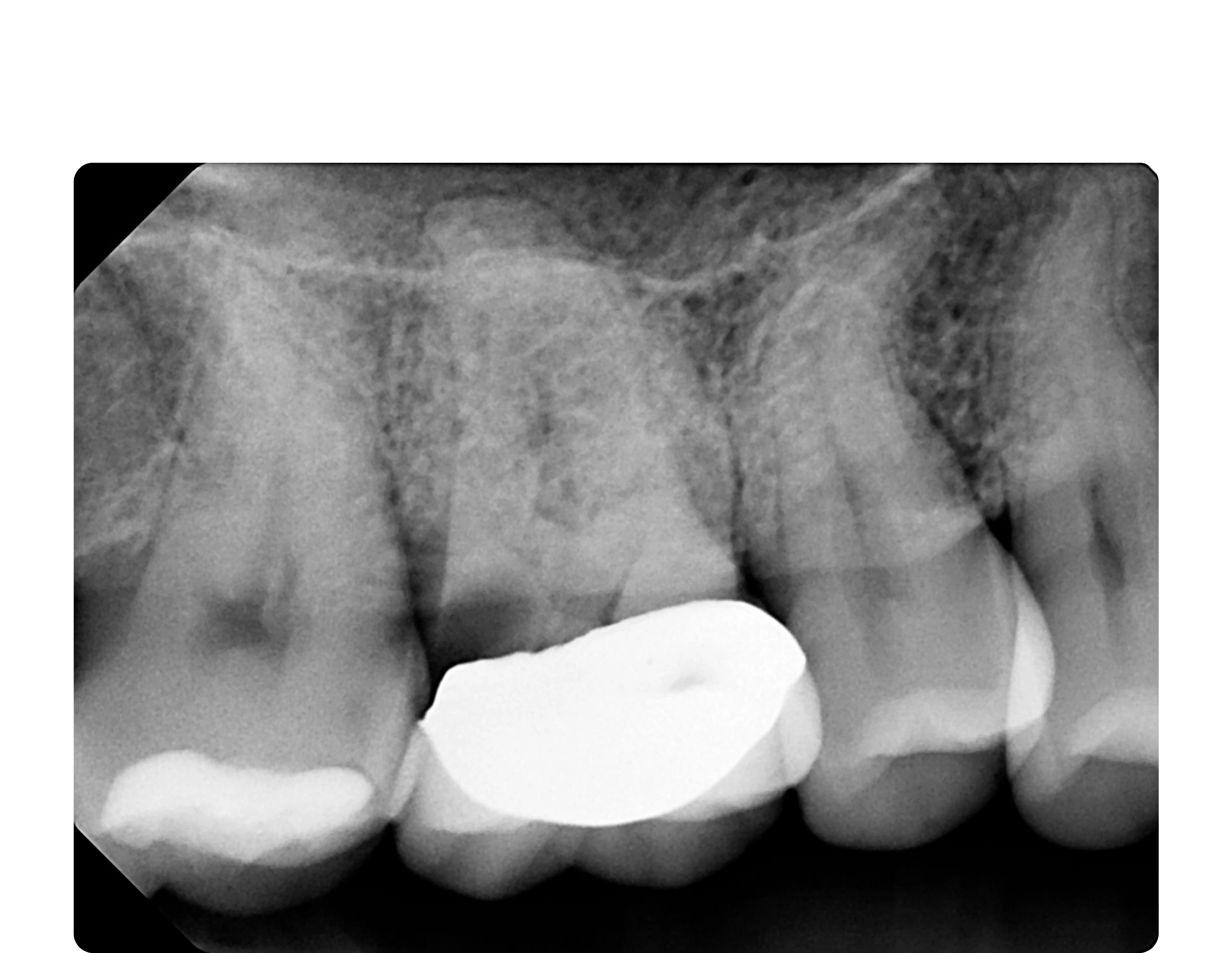 Horizon Implants Thousand Oaks CA (2)