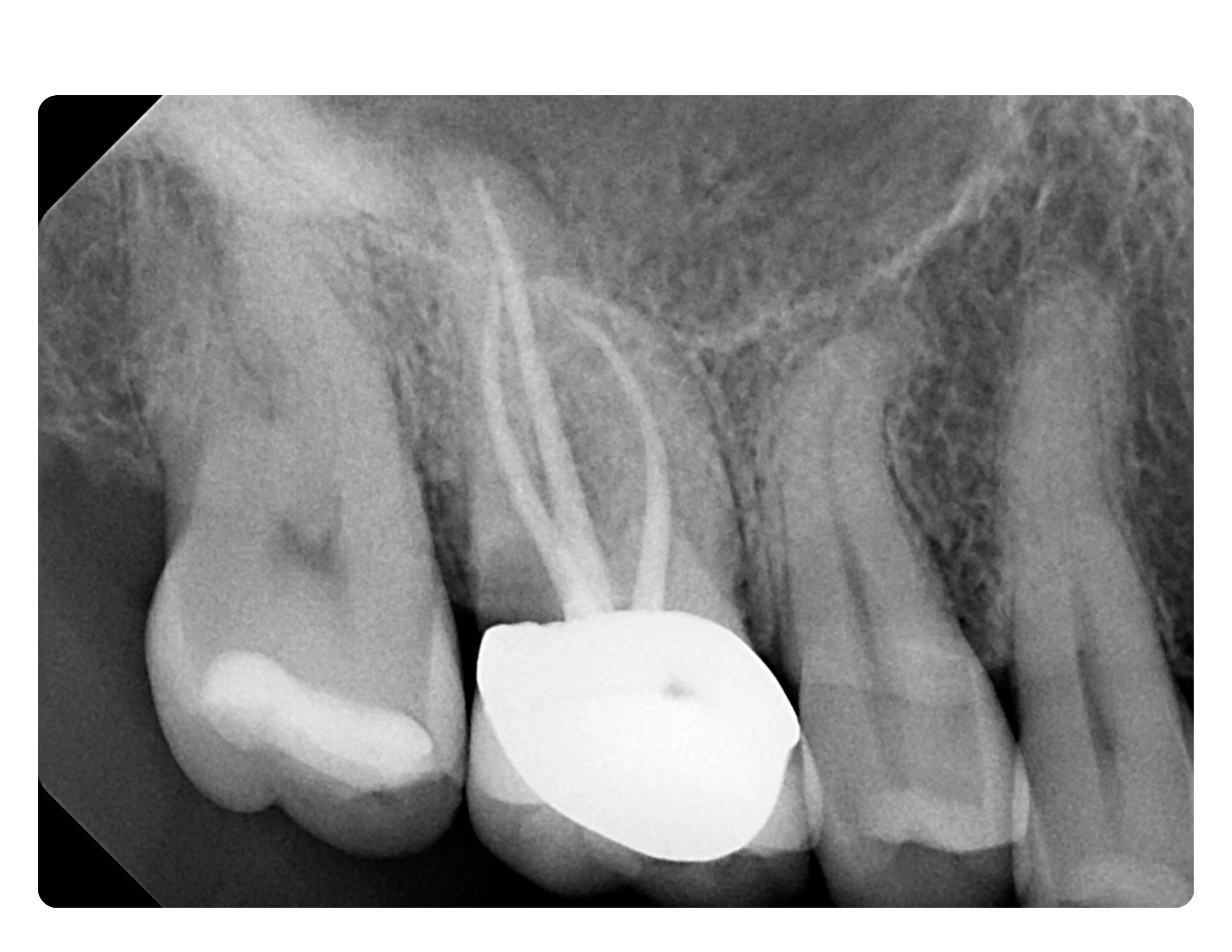 Horizon Implants Thousand Oaks CA (3)