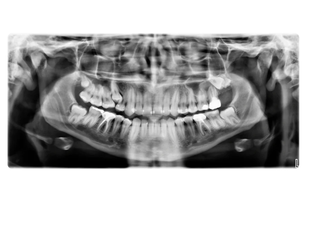 Horizon Implants Thousand Oaks CA (4)
